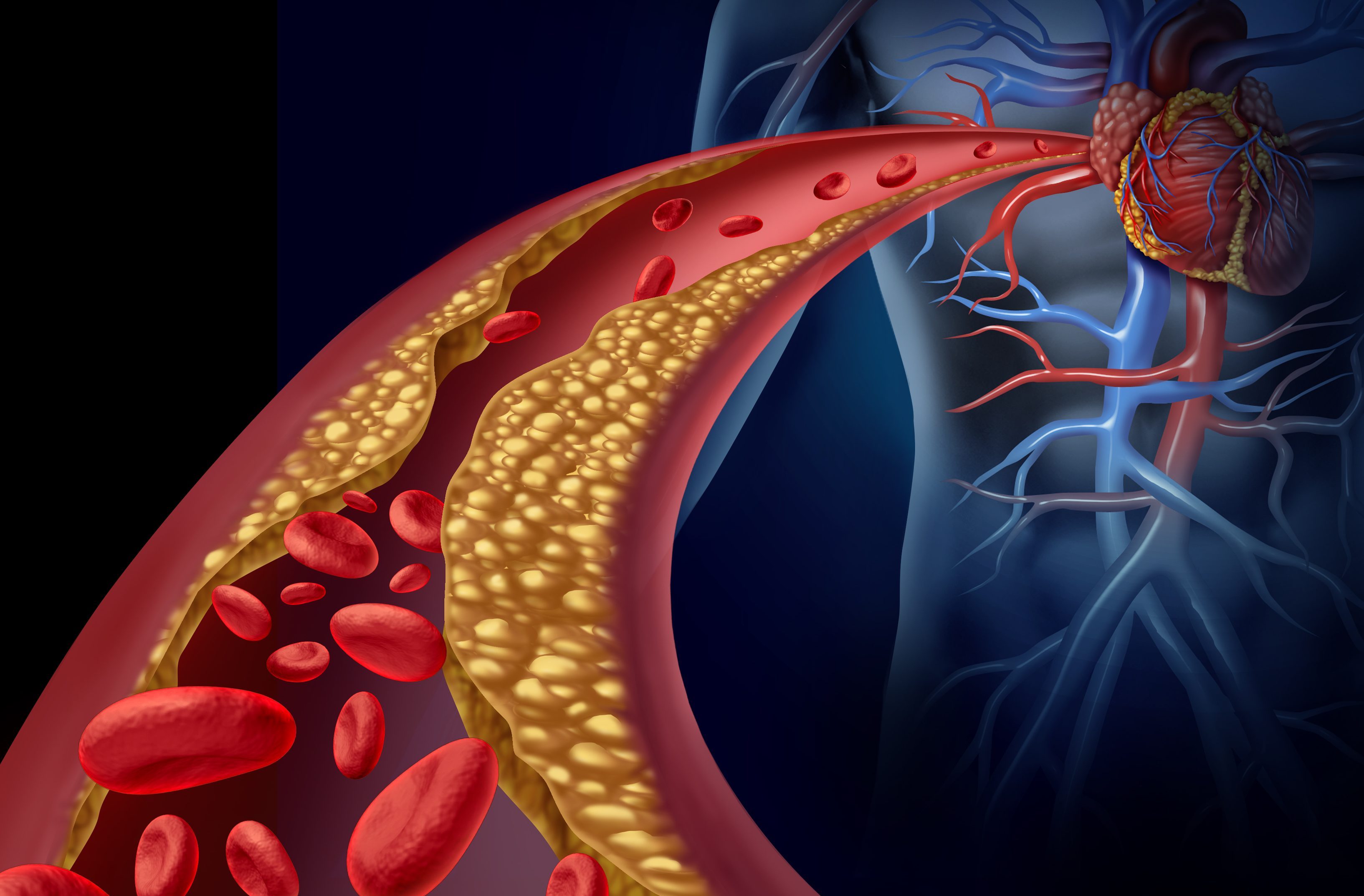 Cholestérol - Healthy-Heart.org